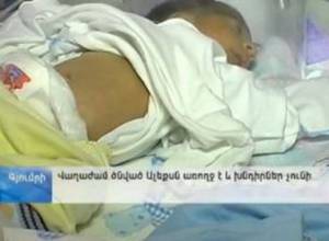 Վաղաժամ ծնված փոքրիկը լավ է զգում