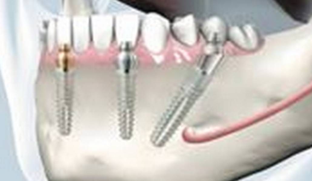 tooth