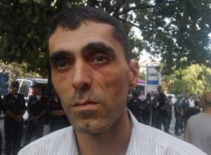 Ոստիկանները վիրավորել են ակցիայի մասնակցին