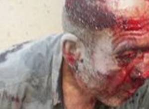 Karabakh war veteran beaten up in Yerevan street