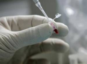 15-year-old girl dies of meningitis