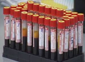 Negative blood types needed