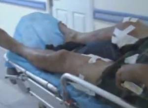 Members of Sasna Dzrer receive soft tissues, bones injuries