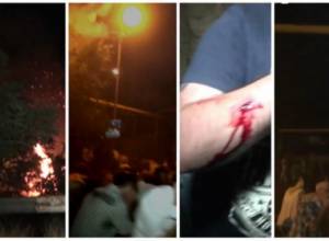 No children hospitalized: Ministry of Health