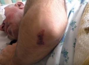 Криминальный Эчмиадзин: “Один схватил сзади, другой – укусил плечо”