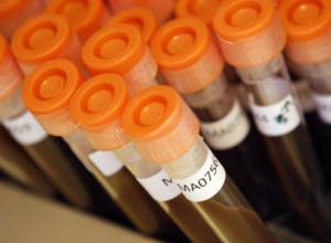 Ученые бьют тревогу о необходимости прививок против детской смертности