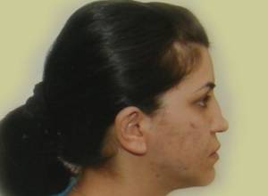 Акция в поддержку избитой женщины