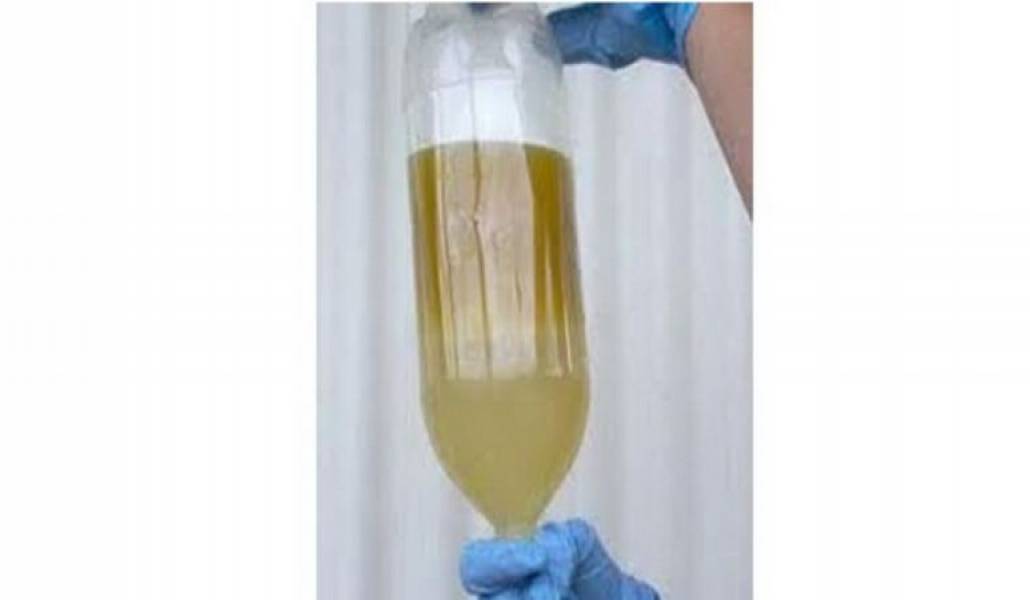 4fce724a5984b96fff1e161b9be369fc