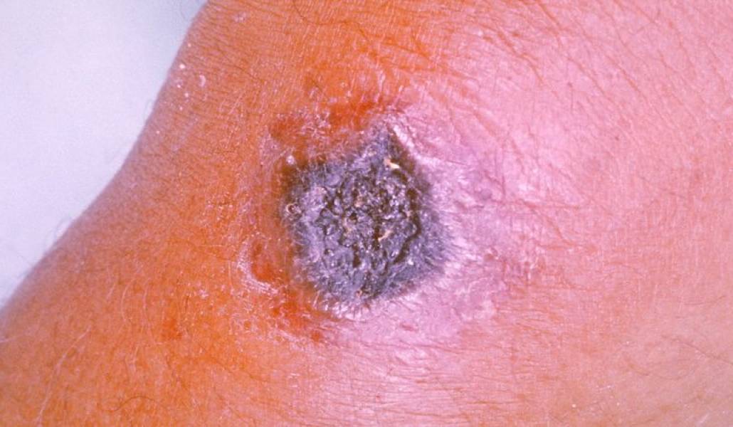 6f916781a62ac52196603043a30ca27e