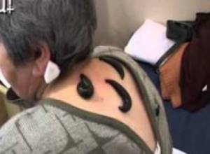 Տզրուկաբուժություն