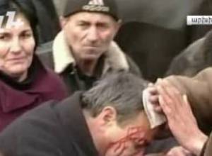 Ինչու լռեցին Մարտի 1-ի վիրավորները