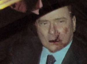 Slivio Berlusconi is hospitalized