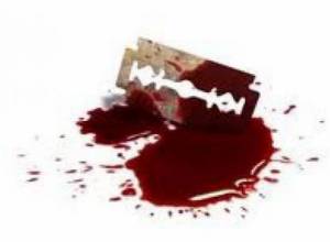 Attempted suicide in Medvedev’s reception room