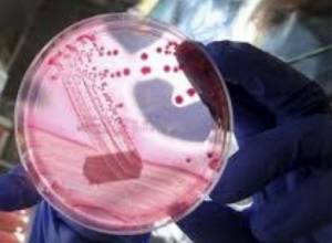 Beansprouts likely cause of deadly E. Coli outbreak