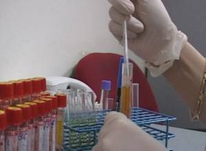 More citizens diagnosed with enteric infection in Yerevan