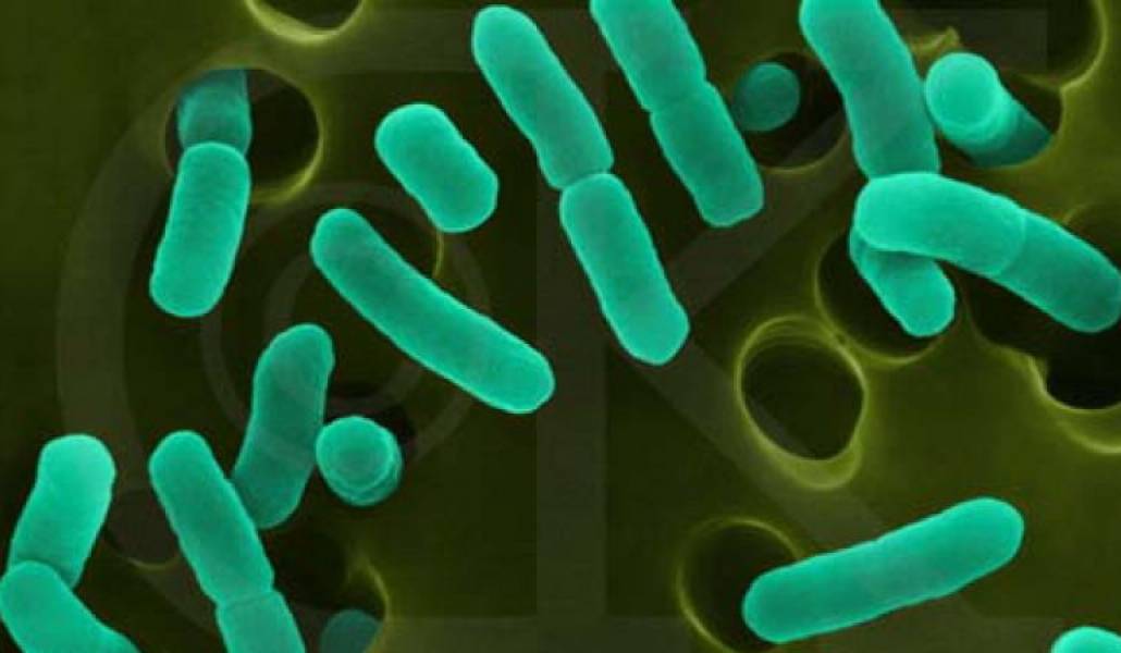 e2624ab611457d9d95a688e4ff95c41c