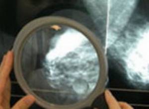 No need for money to treat cancer