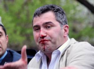 Not in status of the accused yet