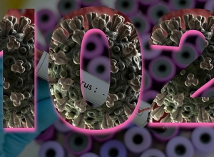 Armenia reports 102 coronavirus cases