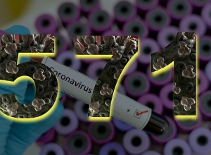 571 confirmed cases of coronavirus