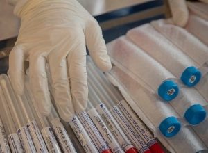 В США диагностируют COVID-19 посредством слюны