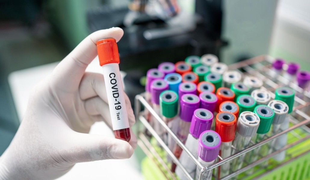 կորոնավիրուս2