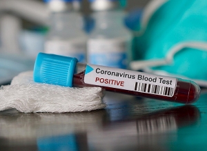 Коронавирус: подтвержденные случаи