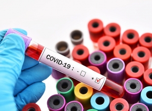 В Арцахе 10 новых случаев COVID-19, 4 человека – члены одной семьи