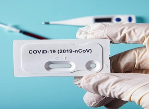 ЕС и ВОЗ передали Армении 10 тыс диагностических тестов