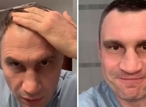 Виталий Кличко показал, как «продержаться» без парикмахеров