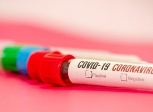 3 новых случая смерти – 2 женщины, 1 мужчина