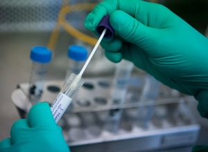 5 случаев смерти за сутки