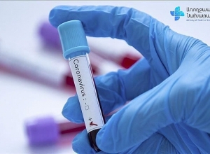 Подтверждено 458 новых случаев коронавируса