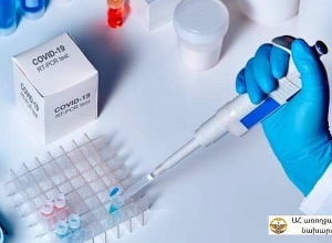 В Арцахе по сегодняшний день зафиксирован 31 летальный исход от коронавируса, 29 из которых – в октябре-ноябре