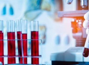 В Арцахе подтверждено 4 новых случая коронавируса