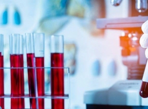 В Арцахе подтверждено 7 новых случаев коронавируса