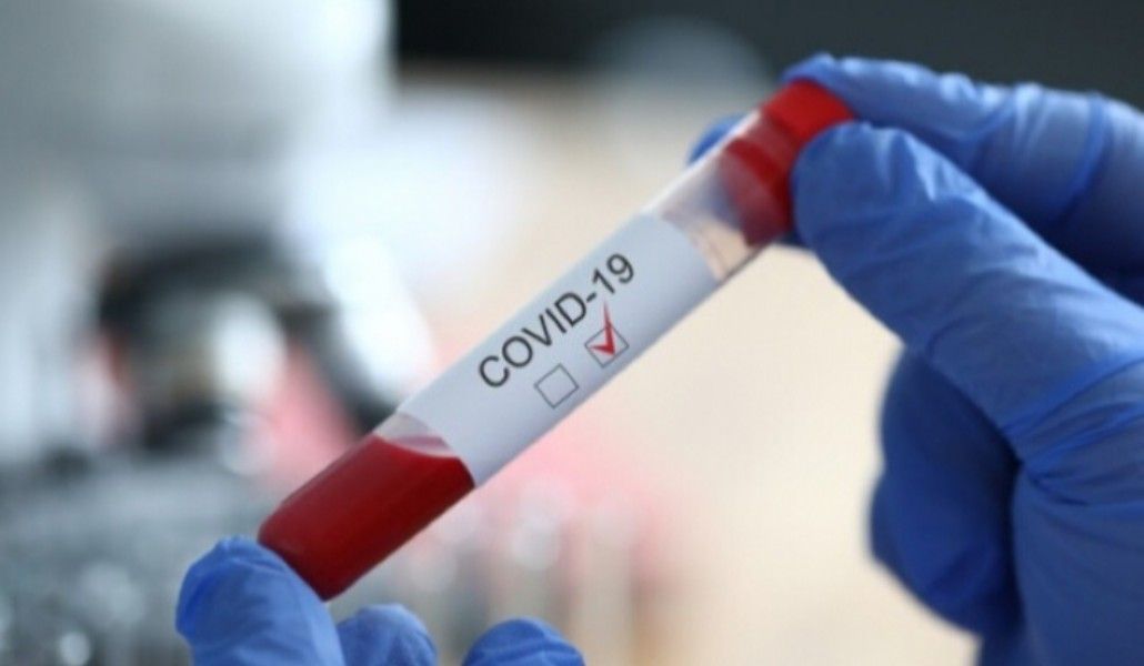 1593361437_1591211895_1589533729_ec58c734-6f65-404a-a85c-ce73fc10504b