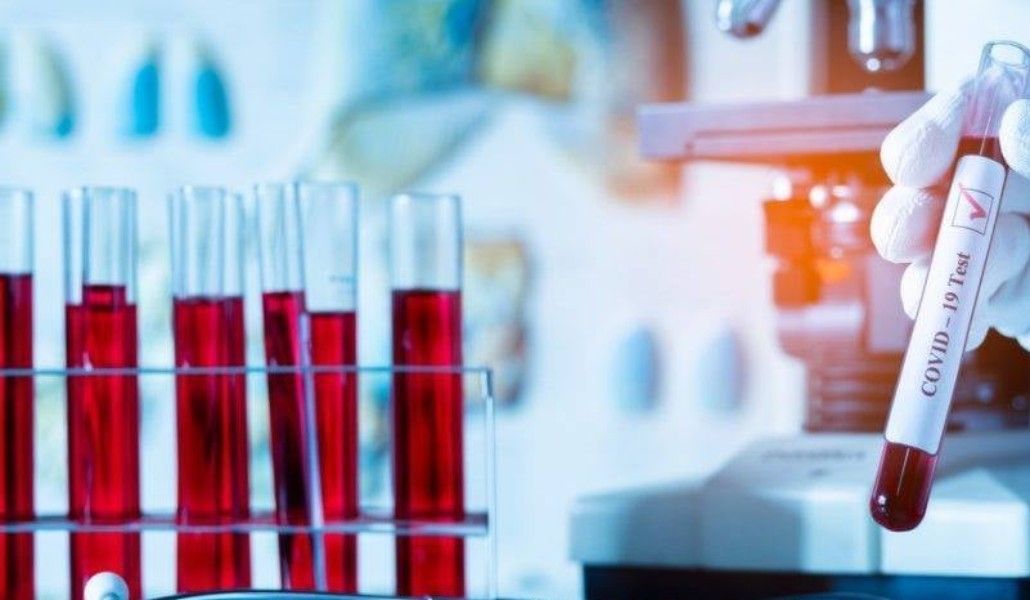 170652916_2852199105053312_9214859874624345013_n