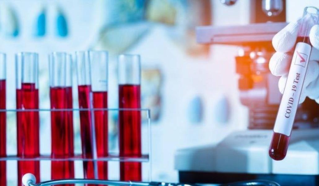 185585854_2877287965877759_5830764261862436431_n