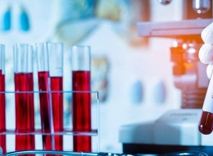 В Арцахе подтверждено 3 новых случая коронавирусного заболевания