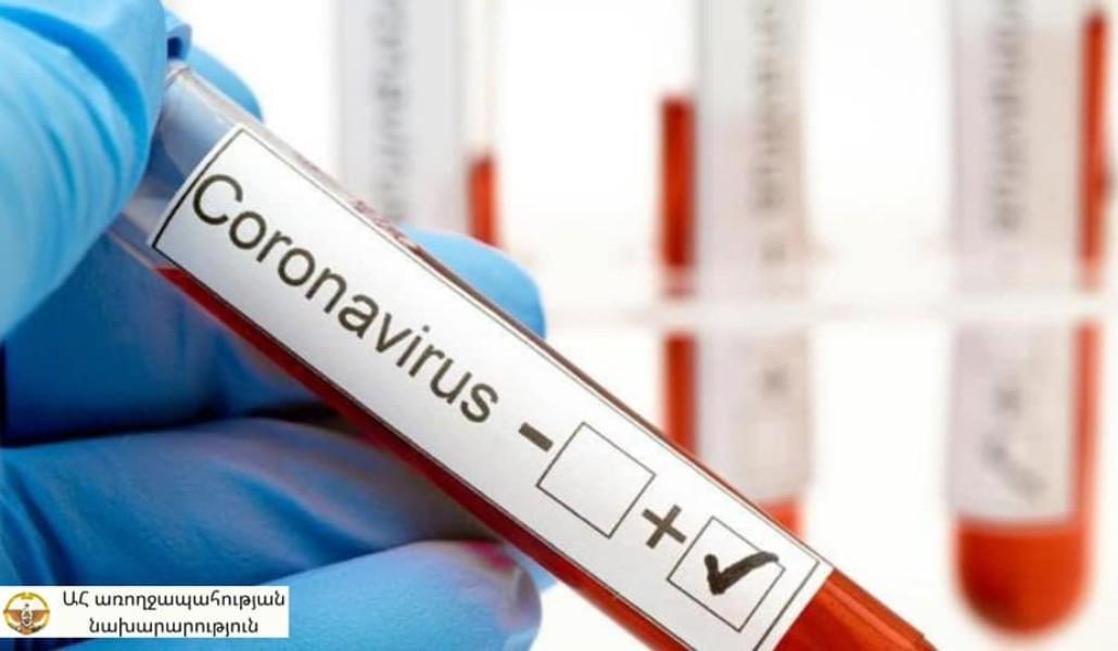 Կորոնավիրուս Արցախ