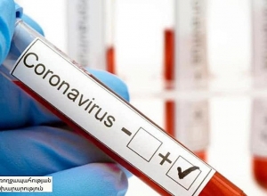 Коронавирус в Армении: за сутки зарегистрировано 212 новых случаев