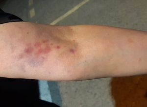 Բերման ենթարկելուց ժամեր անց Զարուհի Փոստանջյանին տեղափոխել են հիվանդանոց