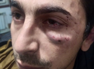   Ոստիկաններին չեն պատժի․ խոշտանգման գործը կարճվել է․ Արայիկ Պապիկյան