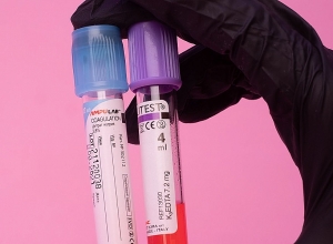 Մեկ մահ կորոնավիրուսից