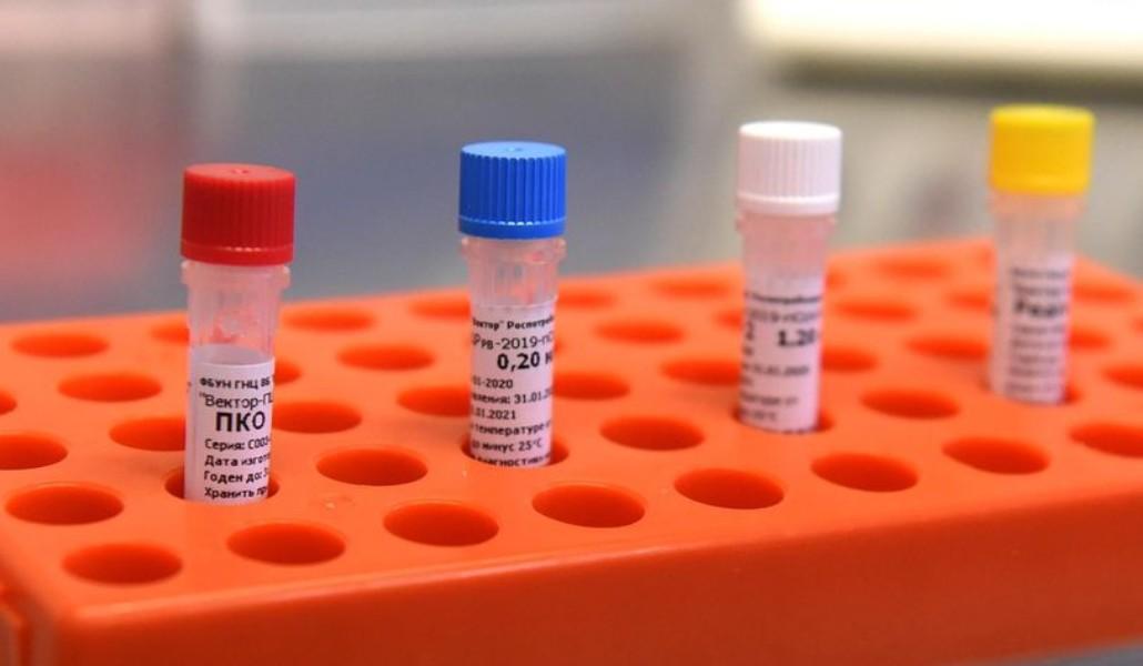 կորոնավիրուսի թեստ