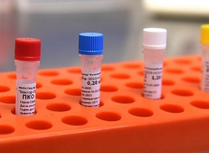 В Армении за последнюю неделю подтверждено 26 случаев коронавируса: скончался 1 гражданин