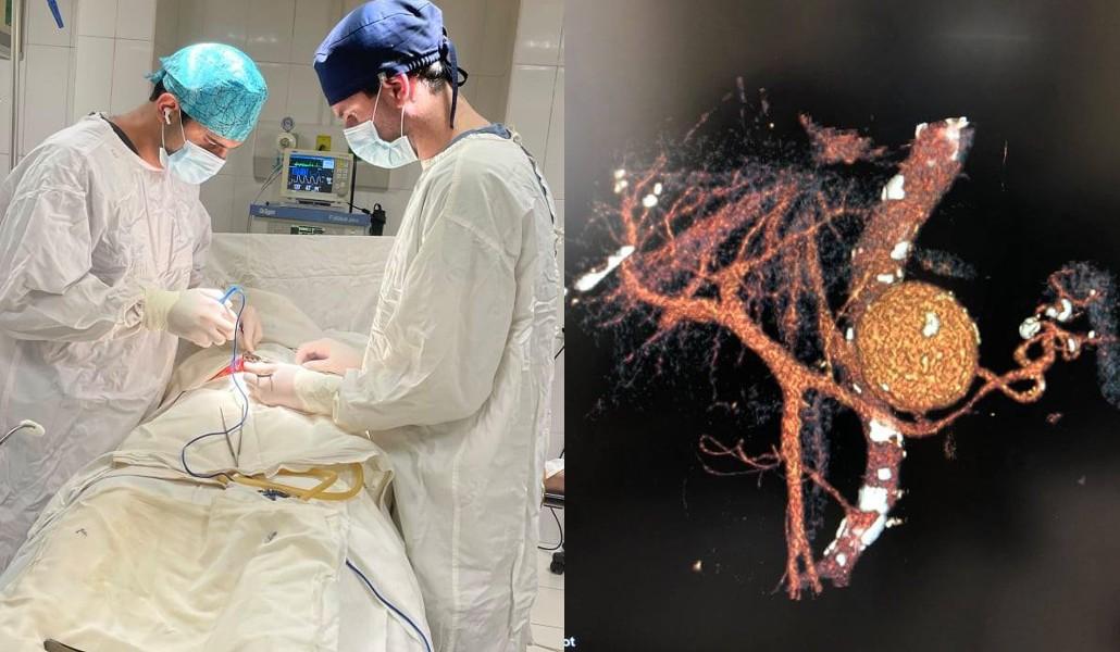 ԵՊԲՀ-վիրահատություն