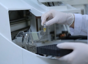 Կուտակումներ՝ բժշկական լաբորատորիաներում․ մի շարք խախտումներ են հայտնաբերվել