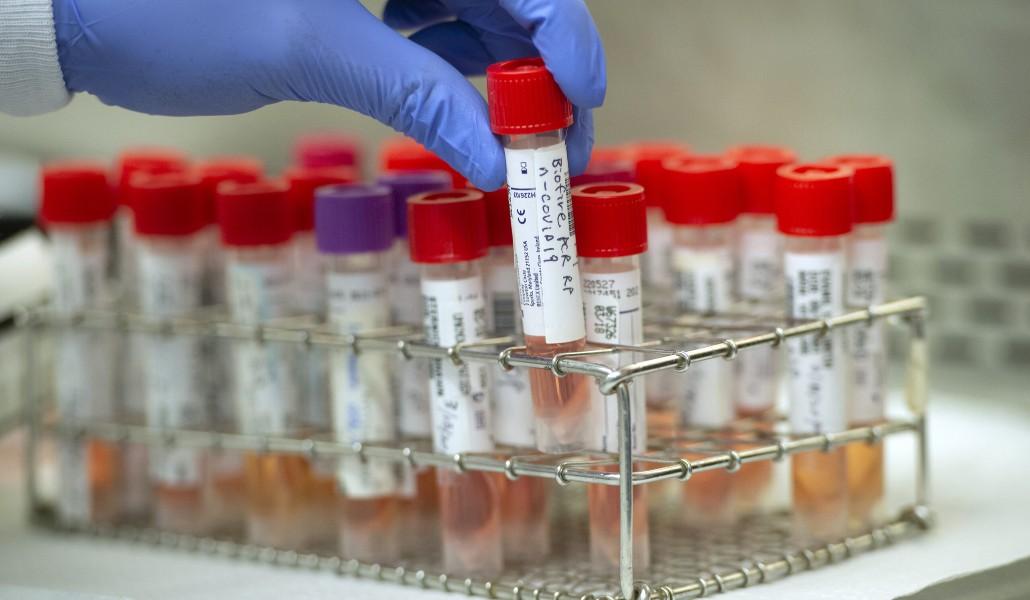 DPH_COVID-19-Testing_Central-Accessioning_05-scaled